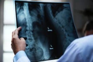 What is a medical assistant - the person assisting with xrays